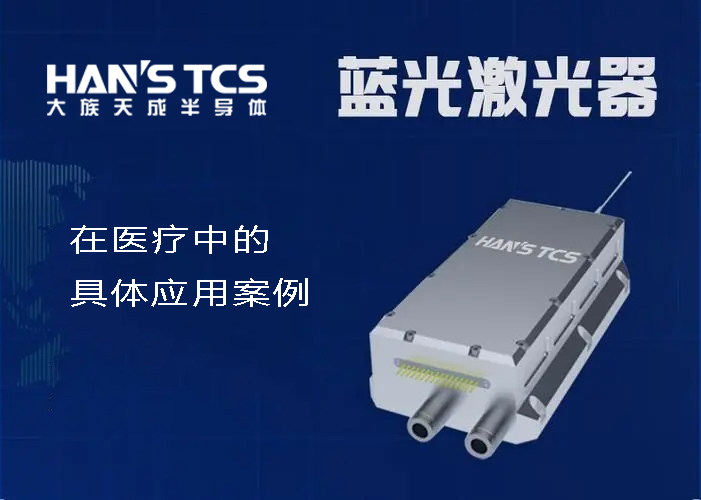 藍光激光器在醫(yī)療中的具體應用案例